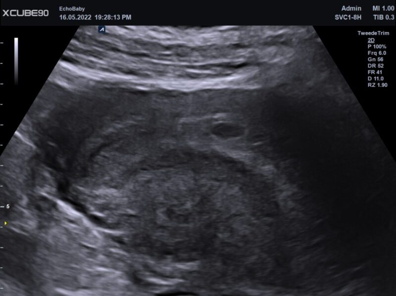 4 weken zwanger