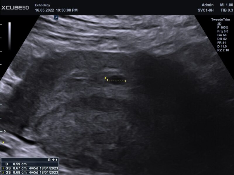 4 weken zwanger foto